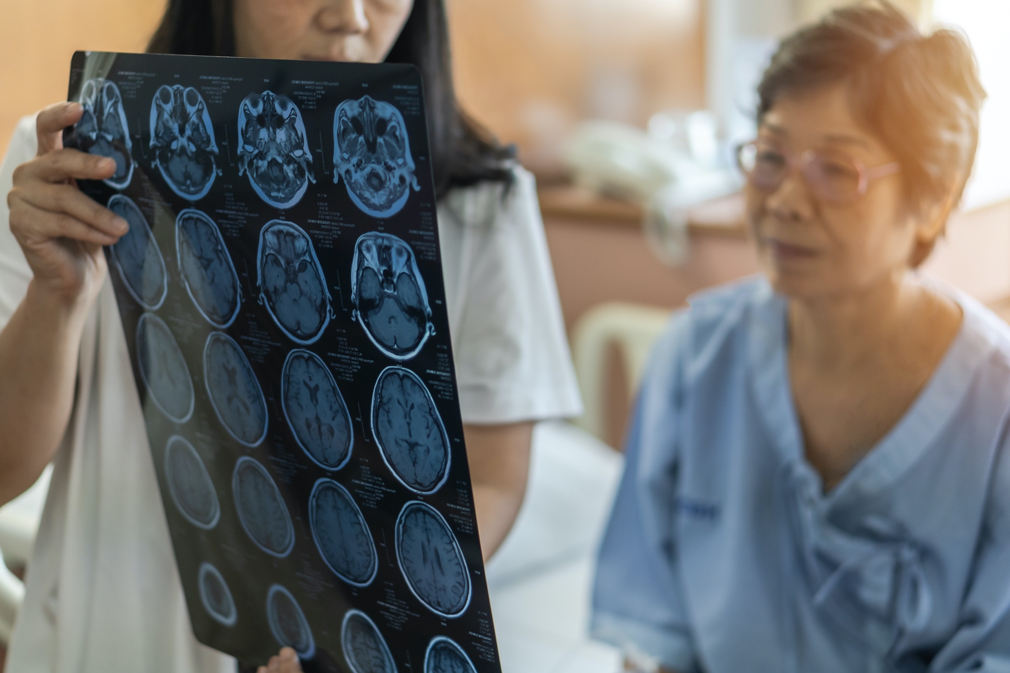 traumatic brain injury lawsuit