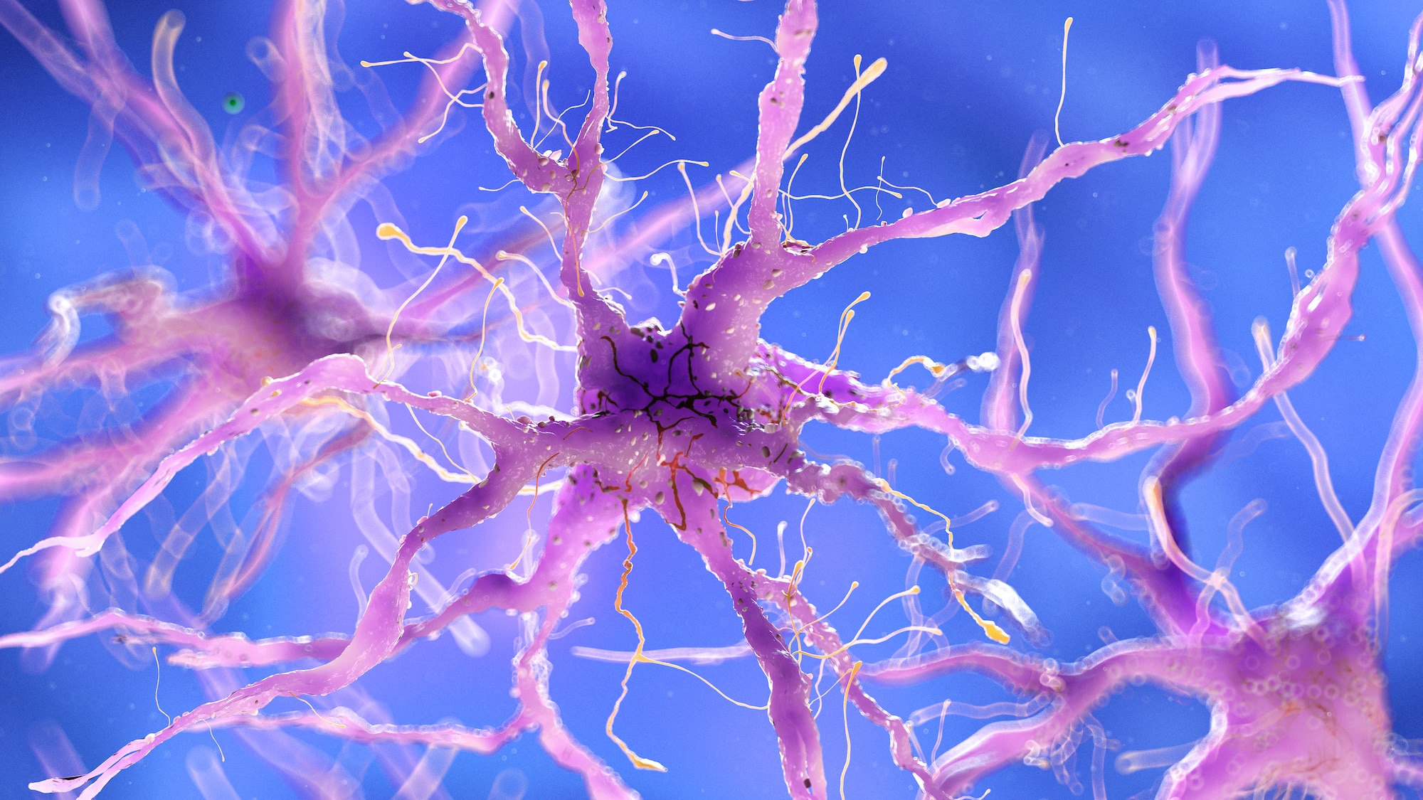 nerve damage lawyer cleveland