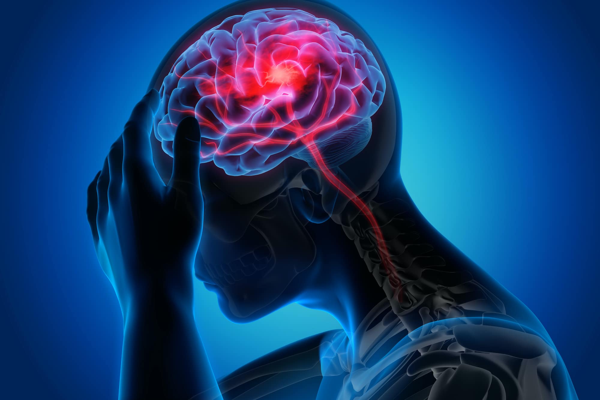 head injury lawyer cleveland