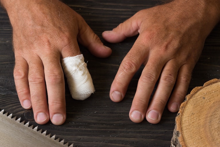 On-the-Job Amputation Injuries