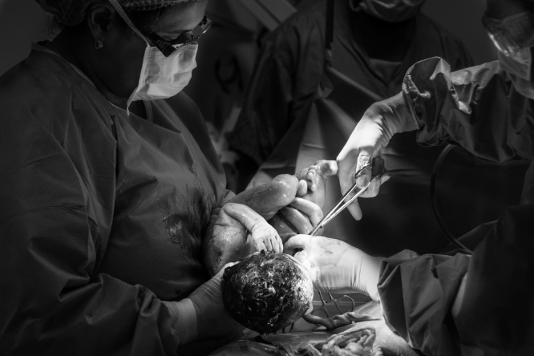  3 Common Signs of Medical Negligence in Birth Injuries