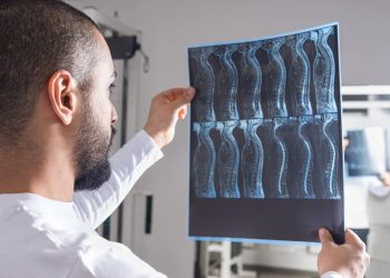 Spinal Cord Injury